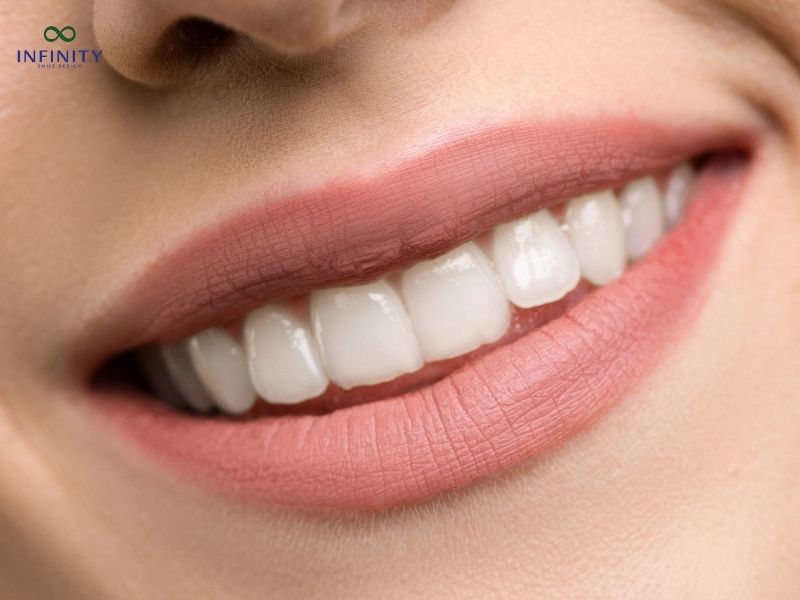 Lưu ý quan trọng khi phục hình răng sứ