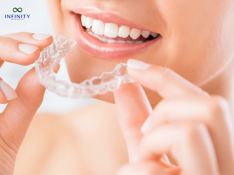 Niềng răng trong suốt (Invisalign)