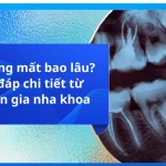 Kéo răng mất bao lâu? Giải đáp chi tiết từ chuyên gia nha khoa
