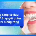 Niềng răng có đau không? Bí quyết giảm đau khi niềng răng