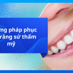 Phương pháp phục hình răng sứ thẩm mỹ