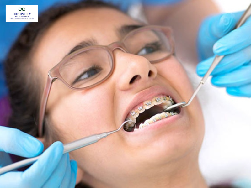 Bước 3: Lập Kế Hoạch Điều Trị Bước 3: Lập Kế Hoạch Điều Trị