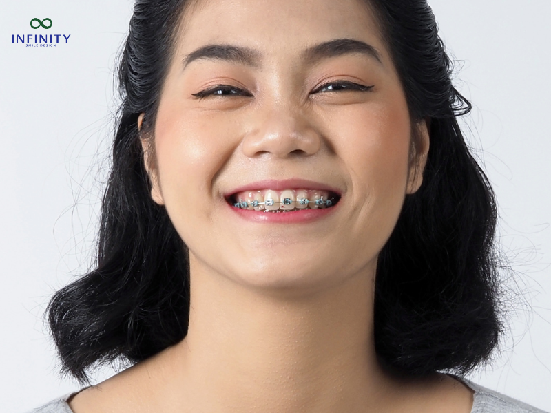 Thay đổi tự nhiên theo thời gian