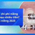 Tổng chi phí niềng răng bao nhiêu tiền? Giá niềng 2025