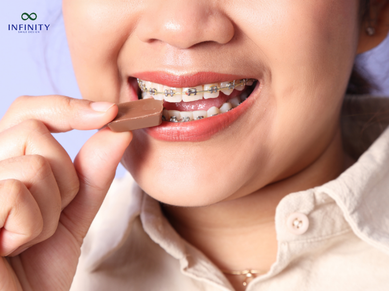Lưu ý quan trọng về cách ăn uống khi niềng răng