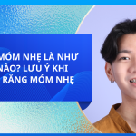 RĂNG MÓM NHẸ LÀ NHƯ THẾ NÀO? LƯU Ý KHI NIỀNG RĂNG MÓM NHẸ 