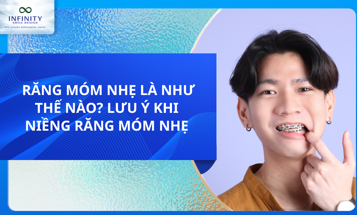 RĂNG MÓM NHẸ LÀ NHƯ THẾ NÀO? LƯU Ý KHI NIỀNG RĂNG MÓM NHẸ 