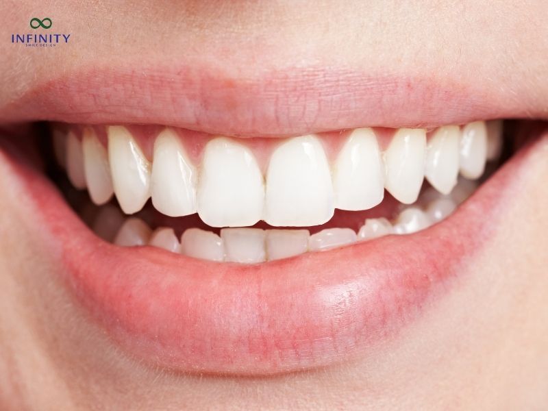 Các yếu tố ảnh hưởng đến chi phí phục hình răng sứ