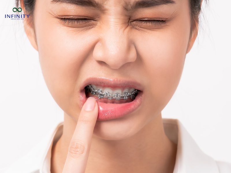 Mất răng lâu năm để lại hậu quả gì?