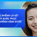 RĂNG KHỂNH LÀ GÌ? CÁCH KHẮC PHỤC RĂNG KHỂNH HÀM DƯỚI