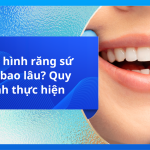 Phục hình răng sứ mất bao lâu? Quy trình thực hiện