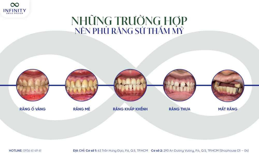 3. những trường hợp
