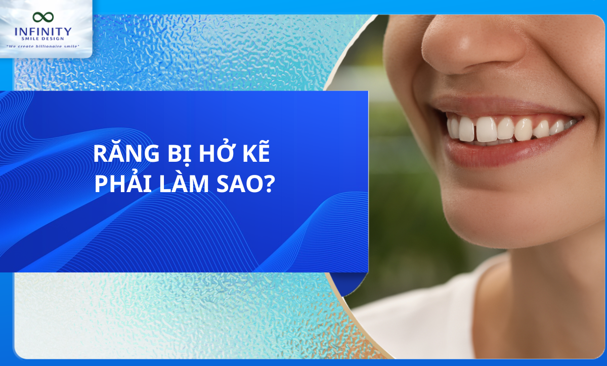 RĂNG BỊ HỞ KẼ PHẢI LÀM SAO?