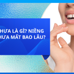 RĂNG THƯA LÀ GÌ? NIỀNG RĂNG THƯA MẤT BAO LÂU?