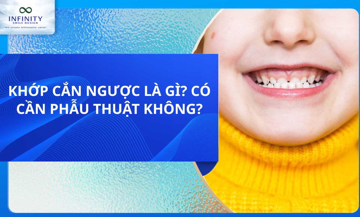 KHỚP CẮN NGƯỢC LÀ GÌ? CÓ CẦN PHẪU THUẬT KHÔNG?