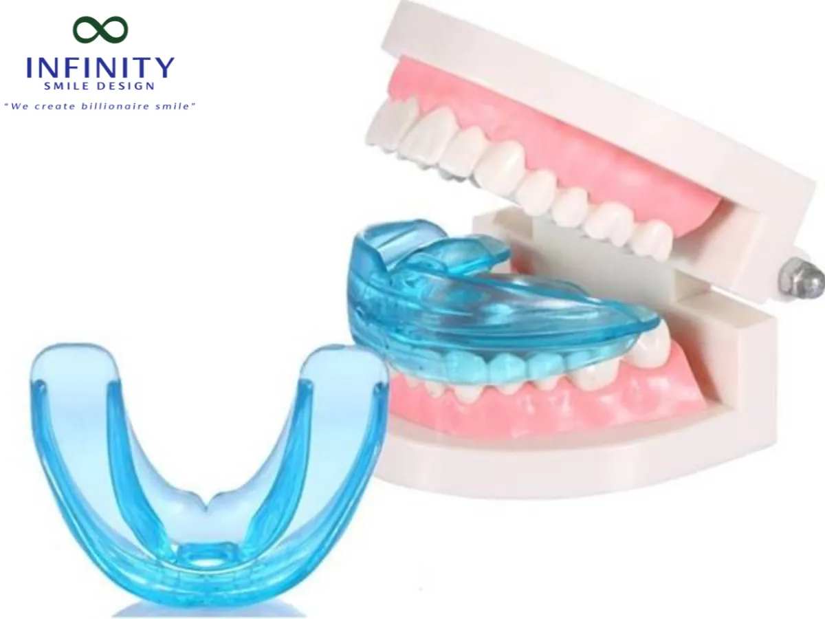 Cảm giác thoải mái khi đeo cũng là một ưu điểm nổi bật, do bộ niềng răng tại nhà không có dây mắc cài gây cọ xát, khó chịu như cách niềng răng truyền thống.
