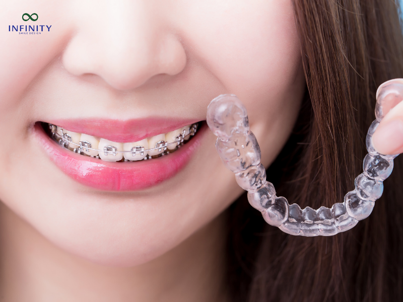 Mẹ bầu có niềng răng được không?