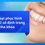 Các loại phục hình răng sứ cố định trong nha khoa