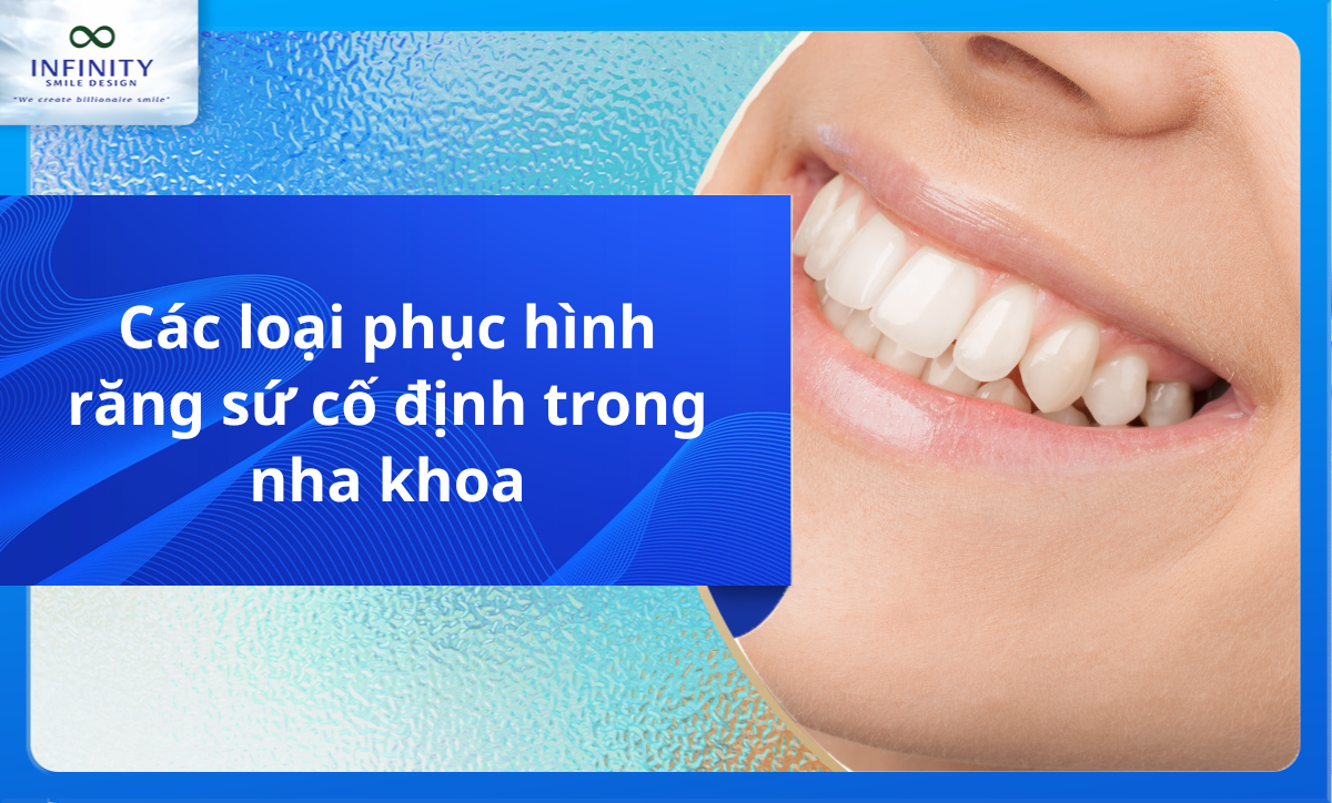 Các loại phục hình răng sứ cố định trong nha khoa