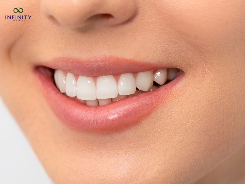 Quy trình phục hình răng sứ chi tiết và thời gian dự kiến