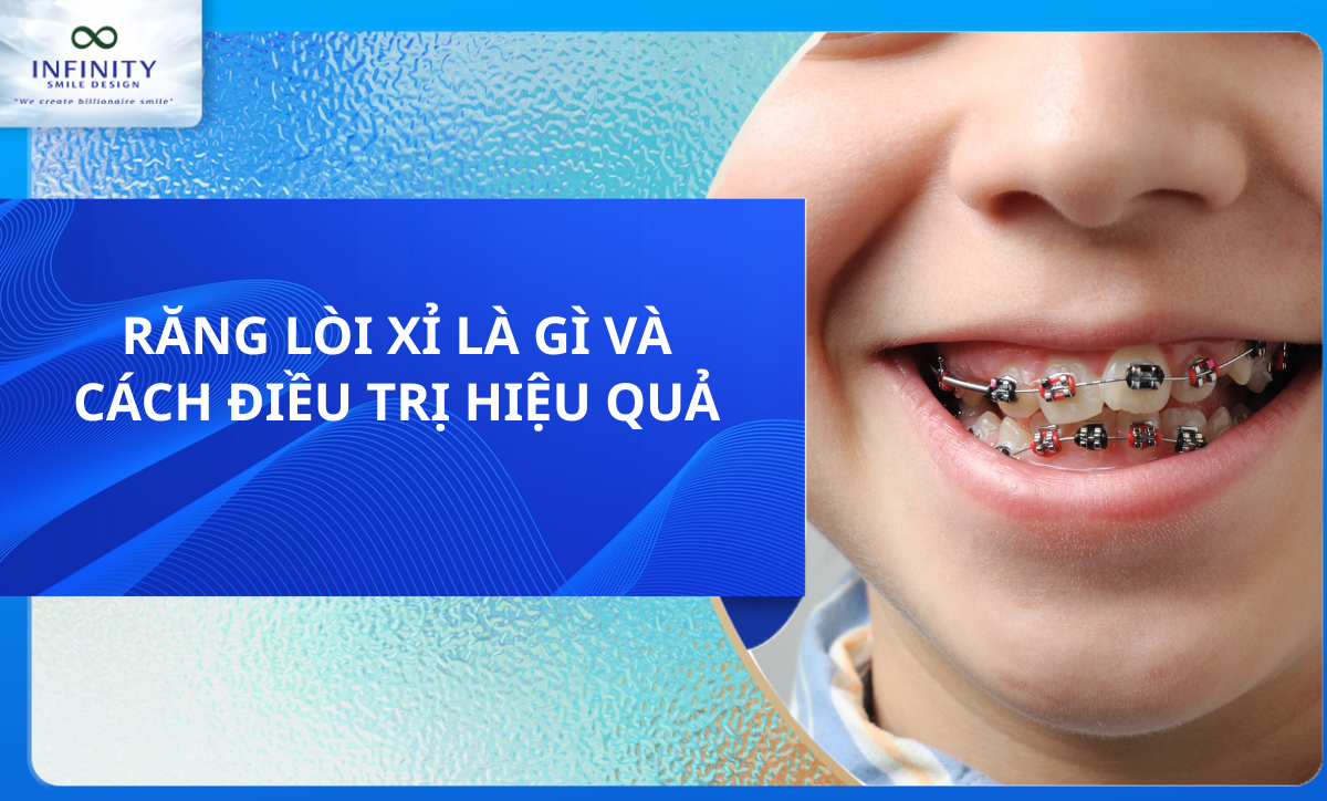 RĂNG LÒI XỈ LÀ GÌ VÀ CÁCH ĐIỀU TRỊ HIỆU QUẢ