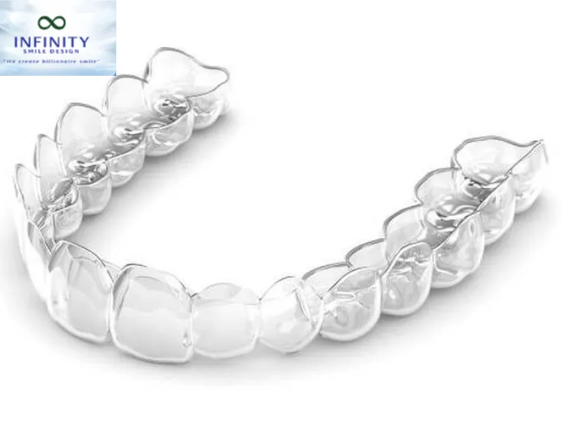 Niềng Răng Bằng Nhựa: Lựa Chọn Cho Nụ Cười Hoàn Hảo 1 Niềng răng bằng nhựa là phương pháp sử dụng các khay niềng trong suốt được làm từ nhựa y tế để chỉnh nha.