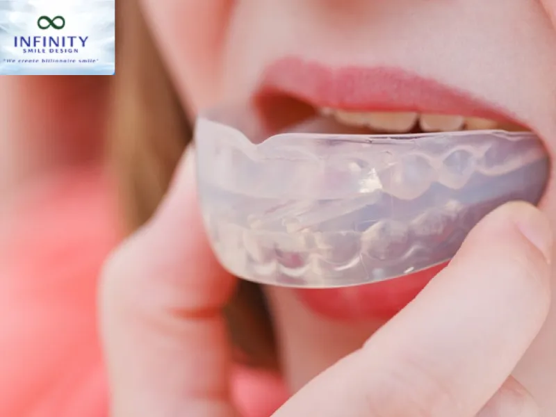 Niềng răng trainer là một công cụ chỉnh nha được thiết kế để giúp điều chỉnh và cải thiện sự phát triển của hàm và răng miệng