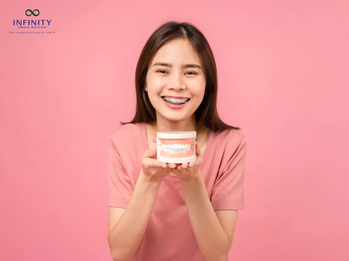 Nguyên nhân gây ra hiện tượng răng chạy lại sau khi tháo niềng