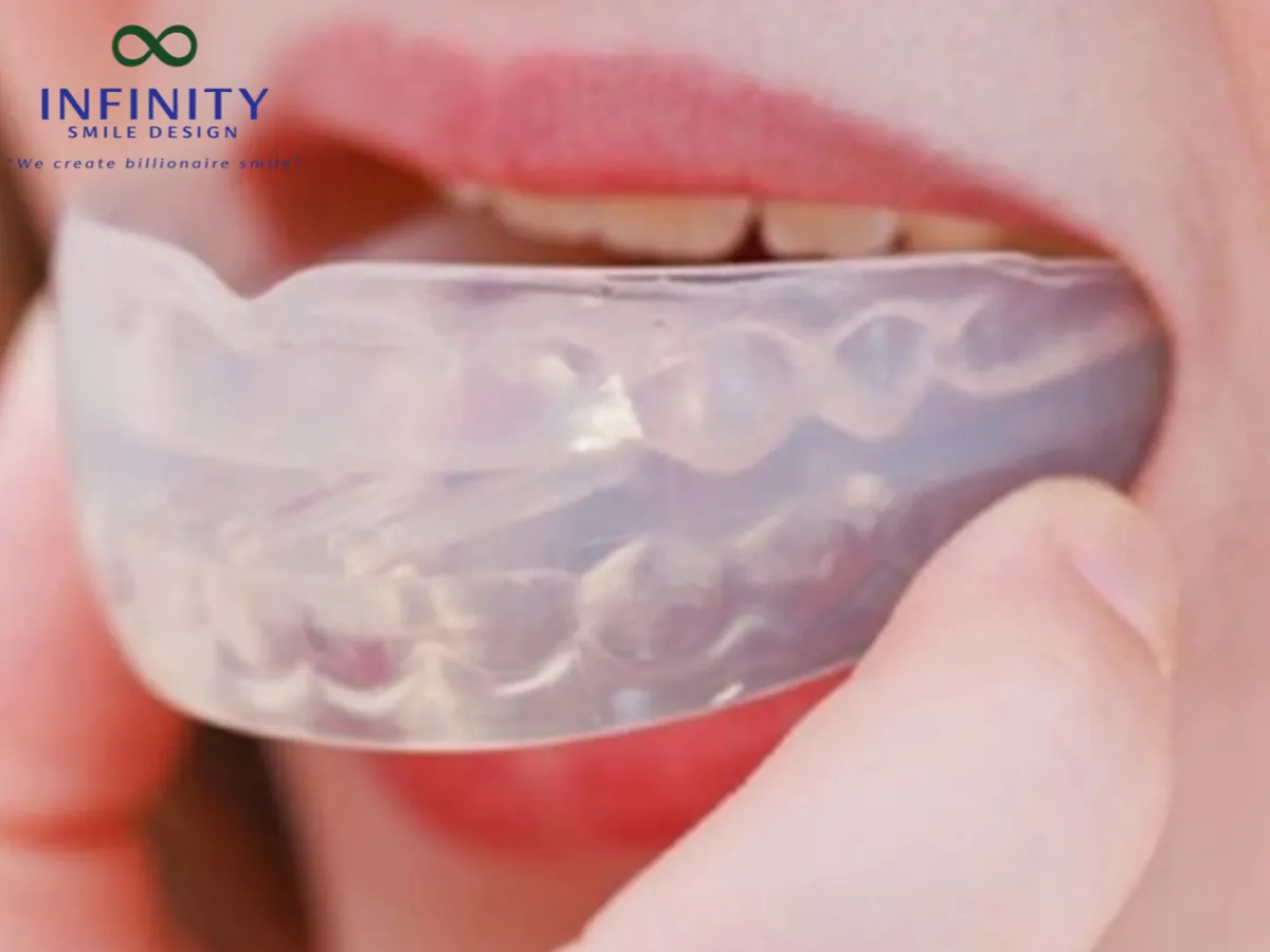 Bộ niềng răng tại nhà ra đời như một giải pháp lý tưởng khi vừa giúp tiết kiệm chi phí, vừa giảm bớt sự bất tiện