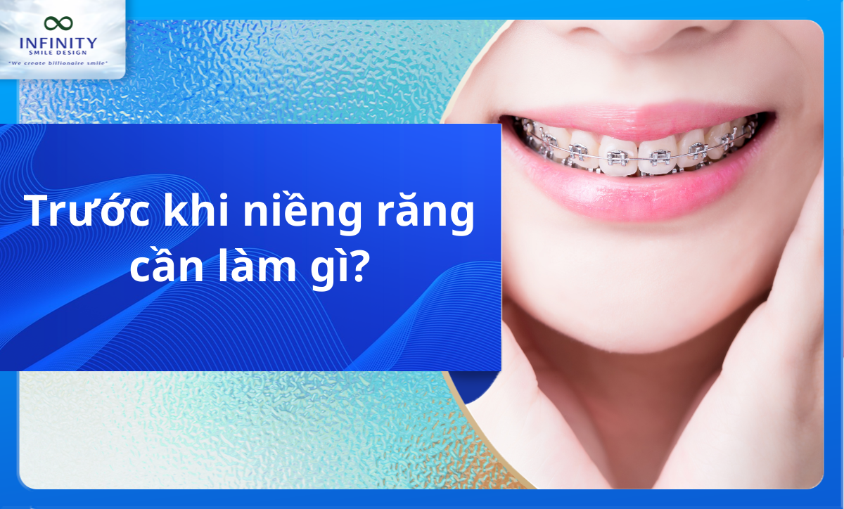 Trước khi niềng răng cần làm gì?
