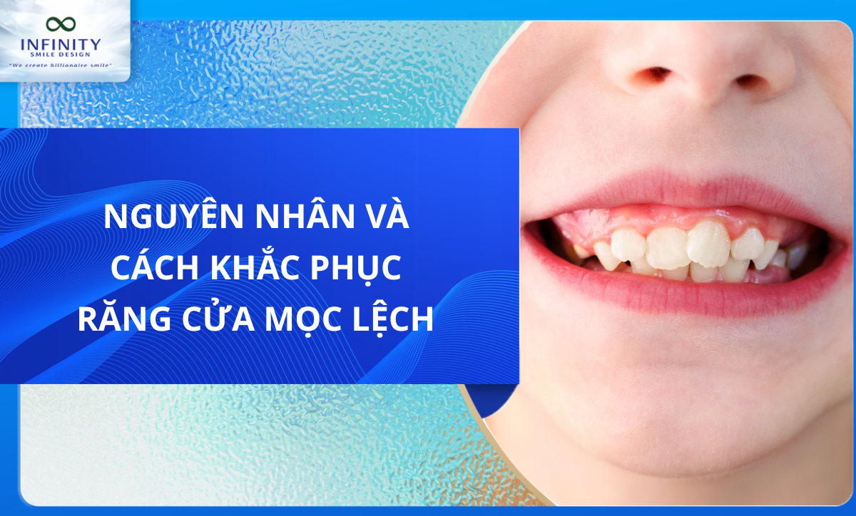 NGUYÊN NHÂN VÀ CÁCH KHẮC PHỤC RĂNG CỬA MỌC LỆCH 