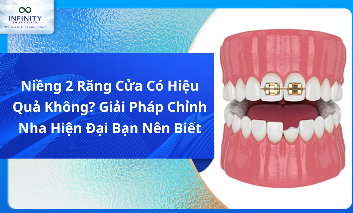 Niềng 2 răng cửa có hiệu quả không? Giải pháp chỉnh nha hiện đại bạn nên biết