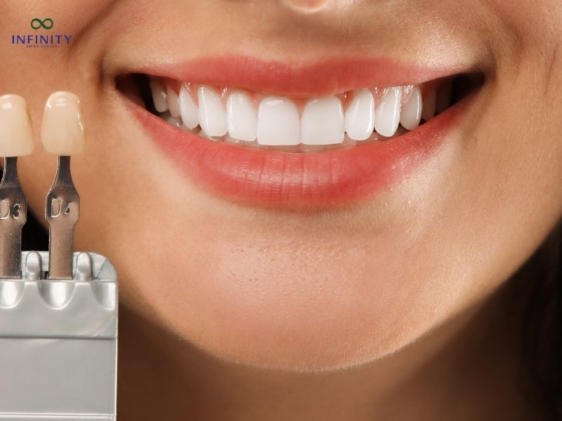 Phục hình răng sứ: Tổng quan về thời gian