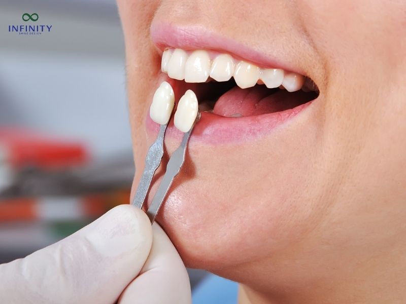 Nguyên Nhân Gây Ra Tình Trạng Răng Thỏ