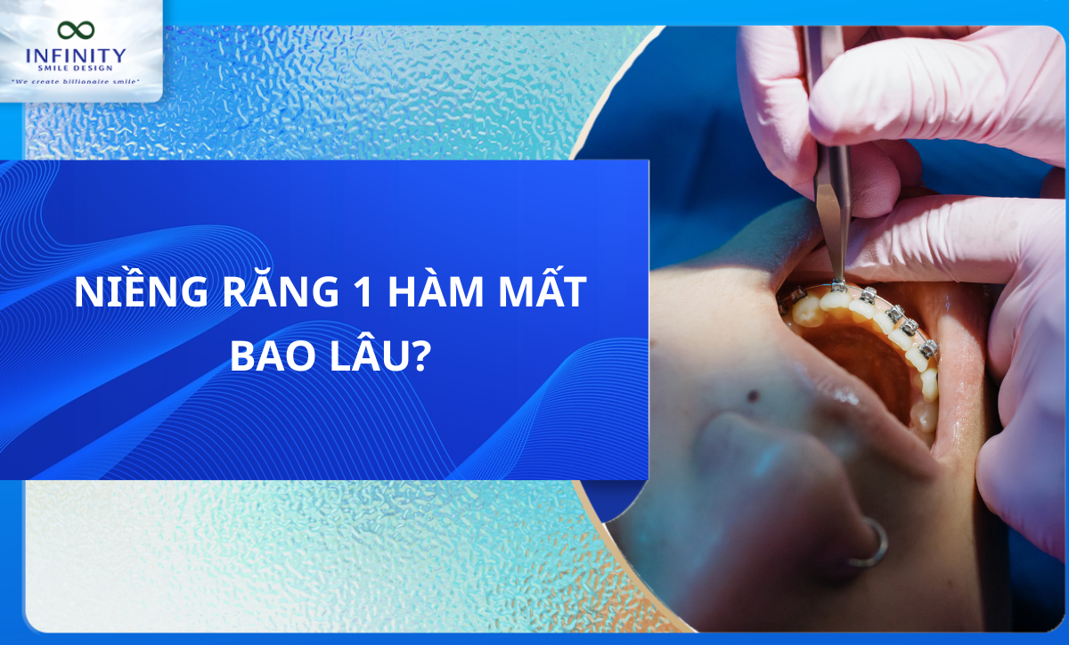 NIỀNG RĂNG 1 HÀM MẤT BAO LÂU?