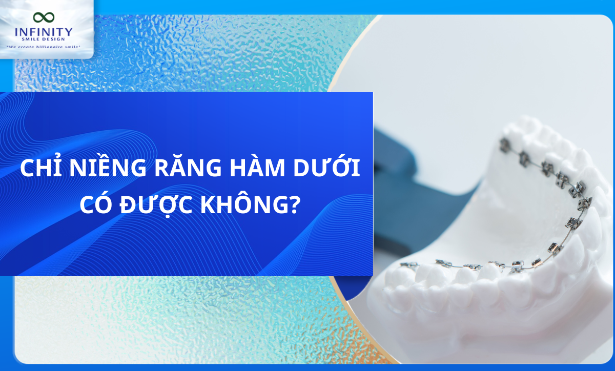 CHỈ NIỀNG RĂNG HÀM DƯỚI CÓ ĐƯỢC KHÔNG?