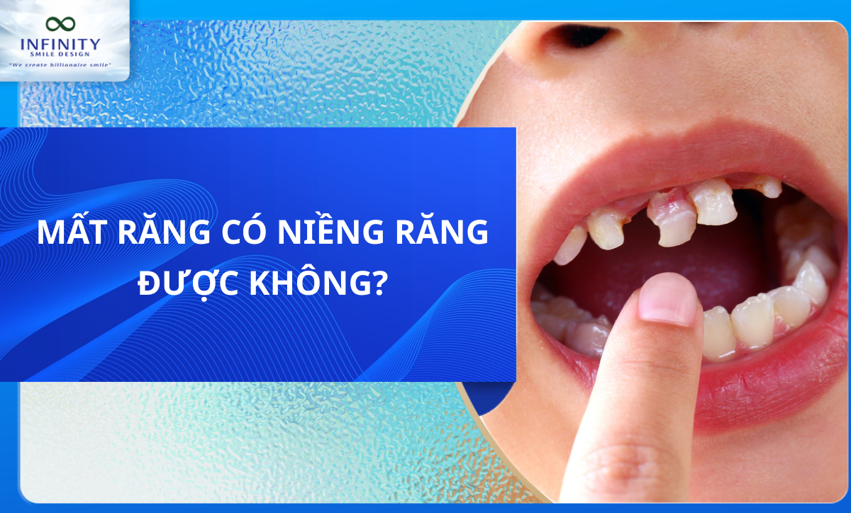 MẤT RĂNG CÓ NIỀNG RĂNG ĐƯỢC KHÔNG?