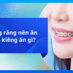 Niềng răng nên ăn gì và kiêng ăn gì?