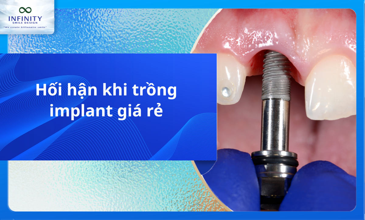 Hối hận khi trồng implant giá rẻ
