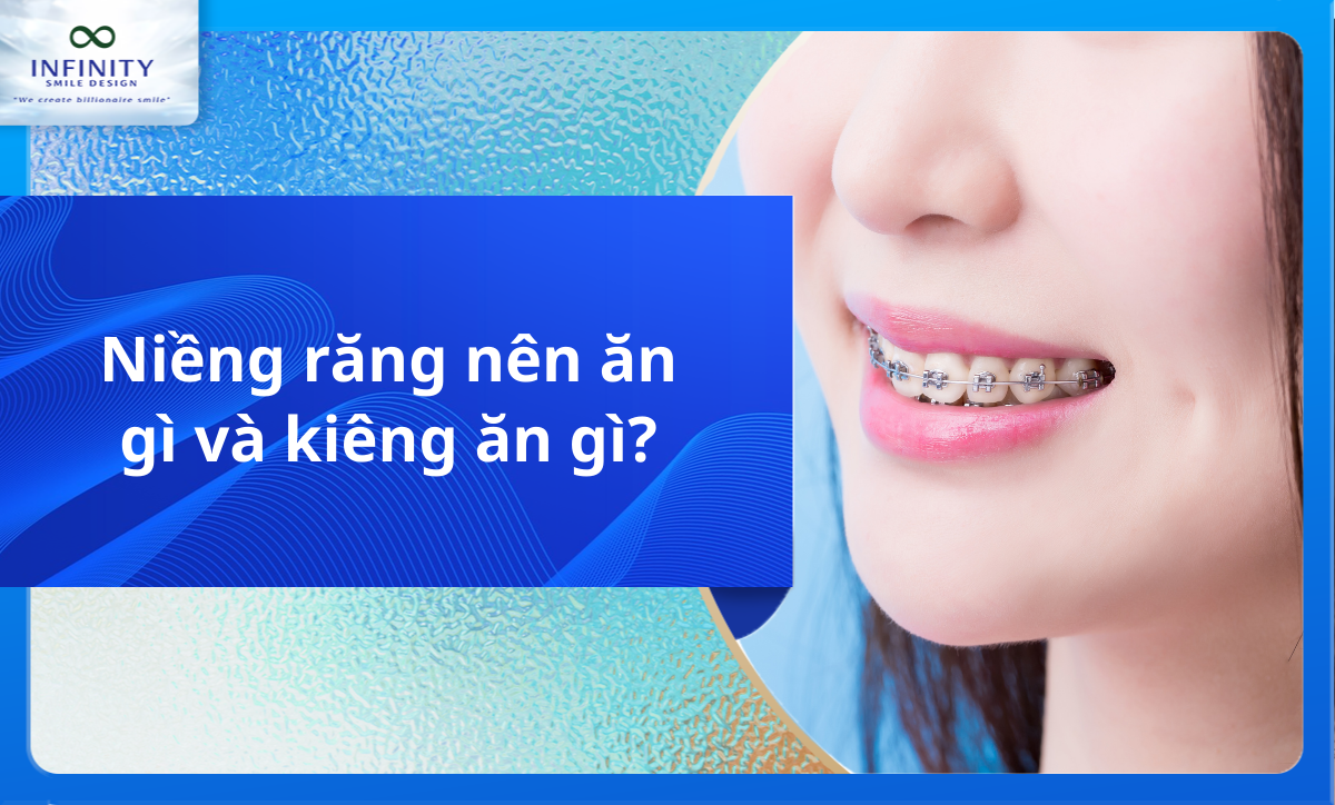 Niềng răng nên ăn gì và kiêng ăn gì?