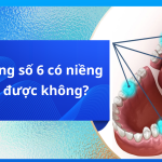 Mất răng số 6 có niềng răng được không?