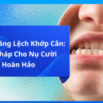 Niềng Răng Lệch Khớp Cắn: Giải Pháp Cho Nụ Cười Hoàn Hảo