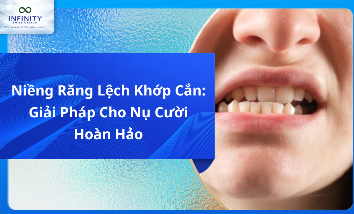 Niềng Răng Lệch Khớp Cắn: Giải Pháp Cho Nụ Cười Hoàn Hảo