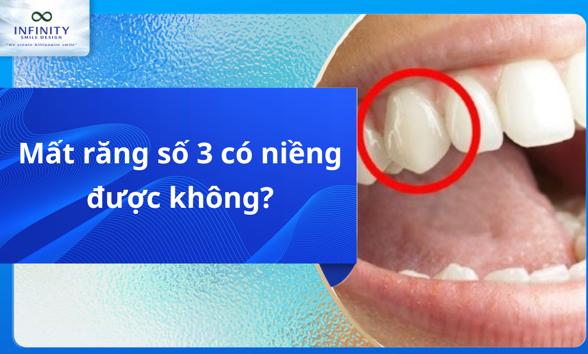 Mất răng số 3 có niềng được không?