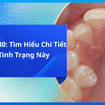 Răng 9630: Tìm Hiểu Chi Tiết Về Tình Trạng Này