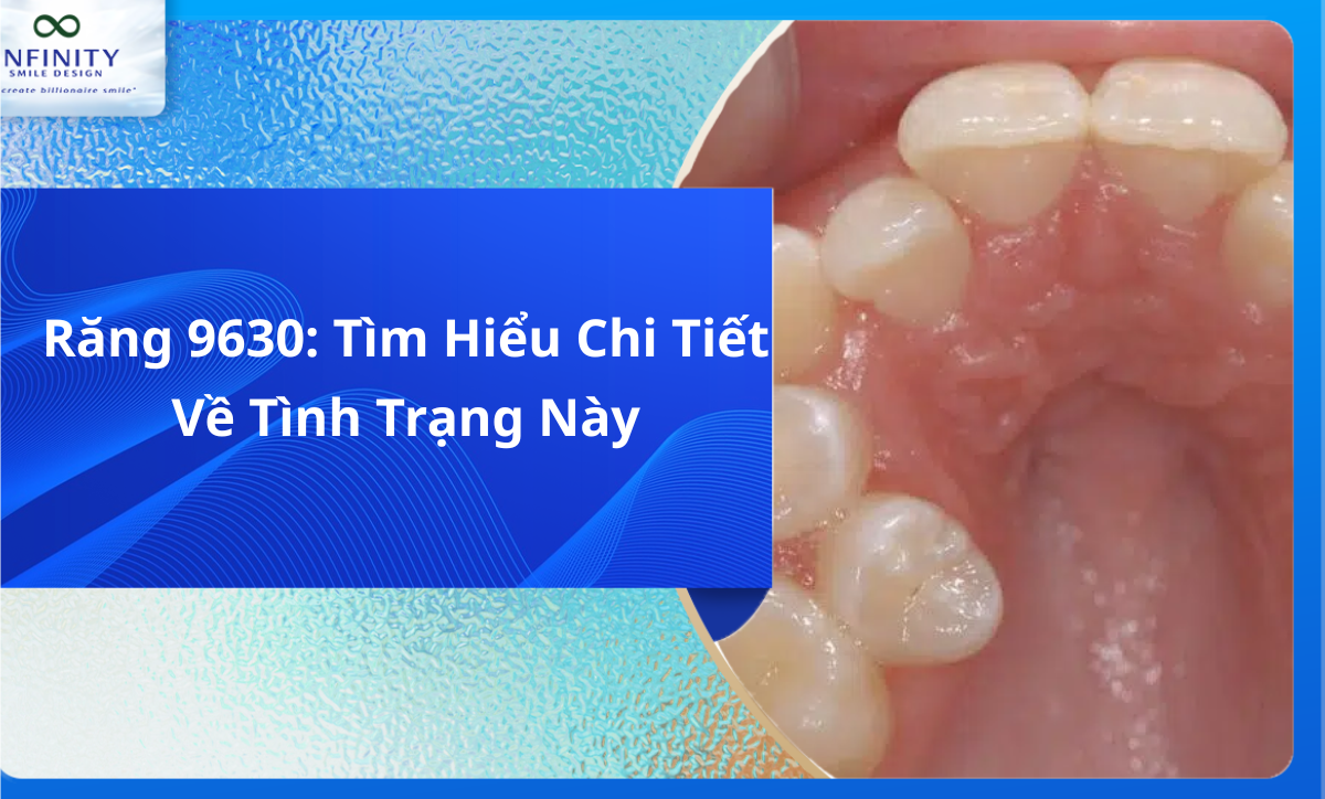 Răng 9630: Tìm Hiểu Chi Tiết Về Tình Trạng Này