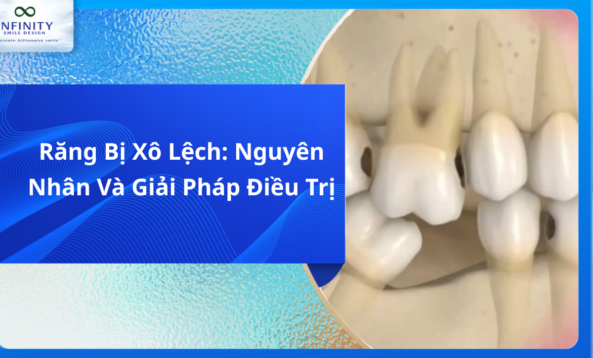 Răng Bị Xô Lệch: Nguyên Nhân Và Giải Pháp Điều Trị