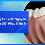 Răng Nanh Mọc Ngầm Là Gì? Tìm Hiểu Chi Tiết