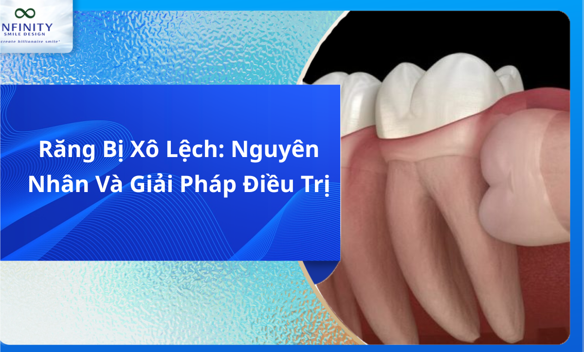 Răng Nanh Mọc Ngầm Là Gì? Tìm Hiểu Chi Tiết