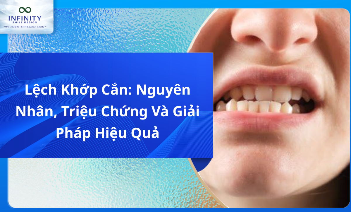 Lệch Khớp Cắn: Nguyên Nhân, Triệu Chứng Và Giải Pháp Hiệu Quả